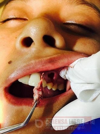 En Paz de Ariporo procedimiento odontológico causó traumas a menor de edad. No hay vigilancia a consultorios