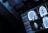 Moderno equipo médico permite a cirujanos localizar de manera exacta lesiones en cerebro y columna