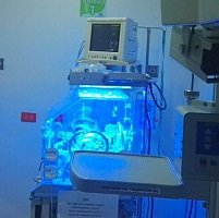 Otro bebé de 5 meses procedente de Aguazul  es atendido en la UCI del Hospital regional por dengue grave