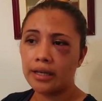 Otra mujer agredida por su pareja el fin de semana en Yopal