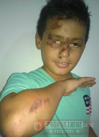 Jinete borracho atropelló a un niño en Villanueva durante Feria Ganadera 
