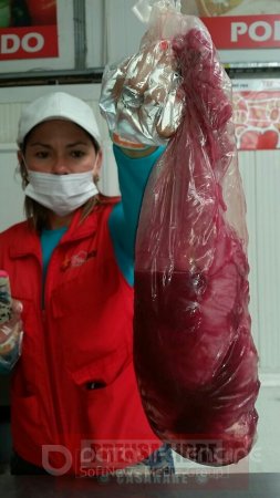 Autoridades  decomisaron en Yopal 50 kilos de carne cruda en mal estado en el Supermercado de Almacenes YEP