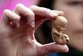 12 casos de aborto provocados al año registra Medicina Legal de Casanare 