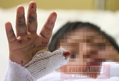 En Yopal está prohibido el uso de pólvora en la celebración de la noche de los niños 