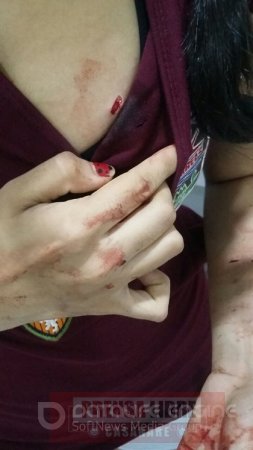 Una mujer fue atacada brutalmente con un pica hielo durante un caso de atraco en Yopal