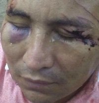 Tres individuos golpearon a joven por robarle la moto en Hato Corozal