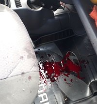 Taxista de Yopal resultó herido en atraco