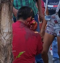Nueva riña en el parque La Estancia de Yopal dejó una persona herida