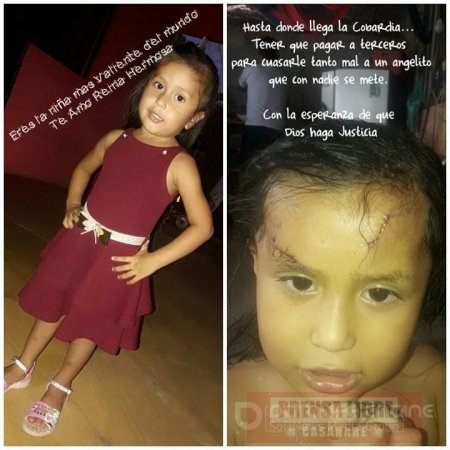 Misterioso ataque a niña de 3 años que fue víctima de heridas con arma blanca 